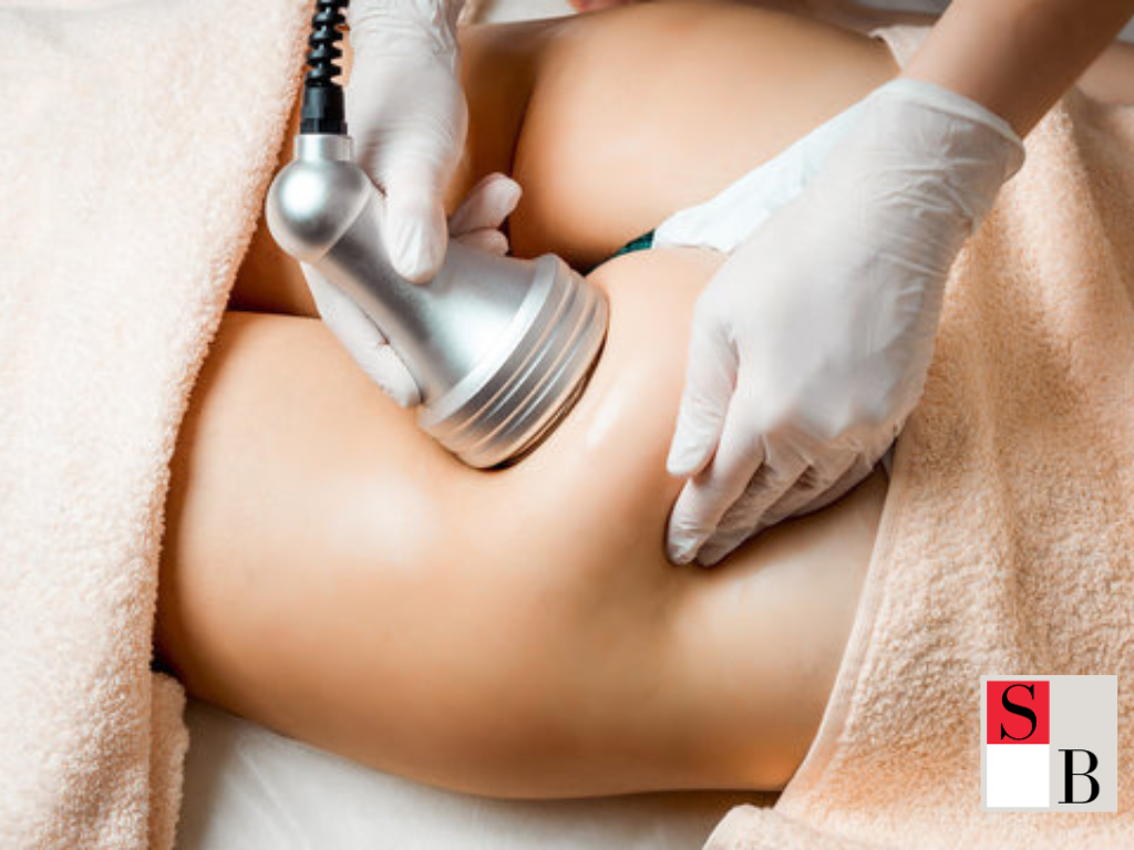 Benefits of Fat Cavitation