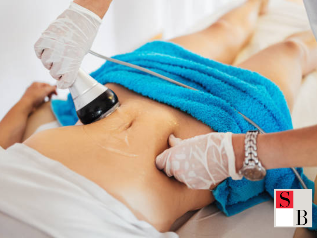 Implementing Fat Cavitation in Your Routine