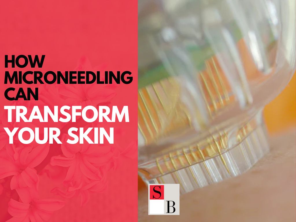 How Microneedling Can Transform Your Skin in Singapore