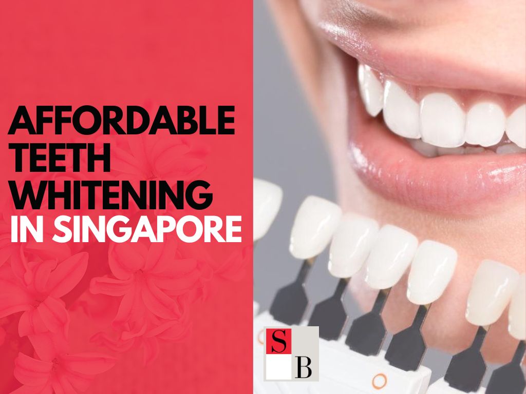 Smile Bright: Affordable Teeth Whitening in Singapore