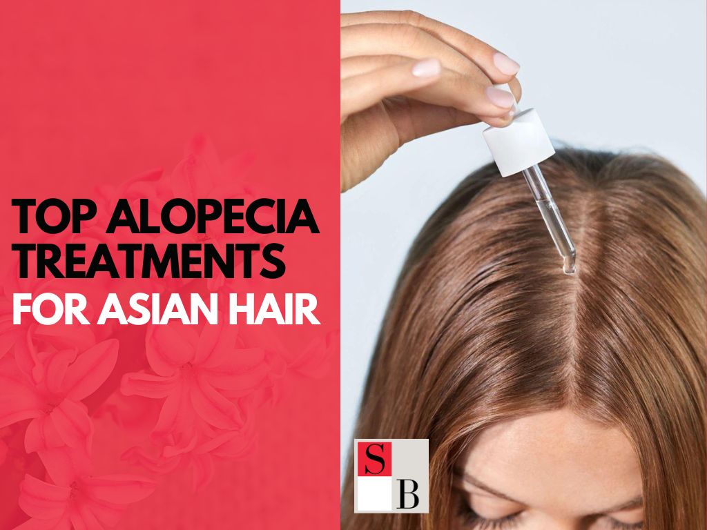 Top Alopecia Treatments for Asian Hair