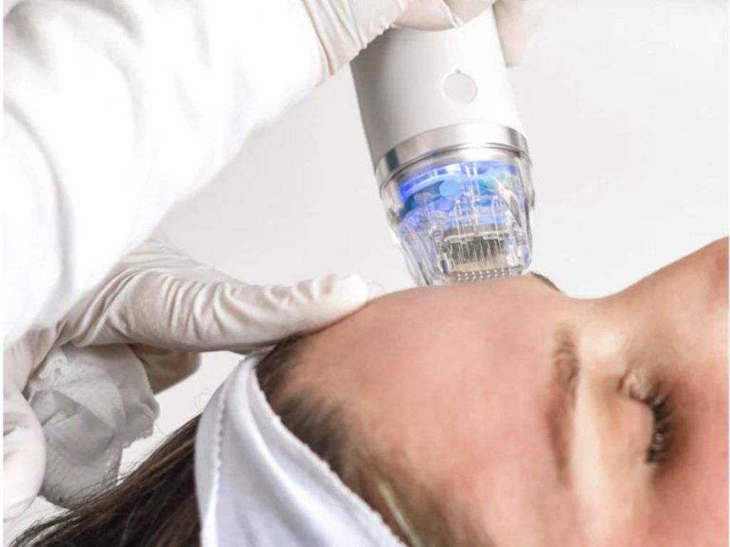 Microneedling