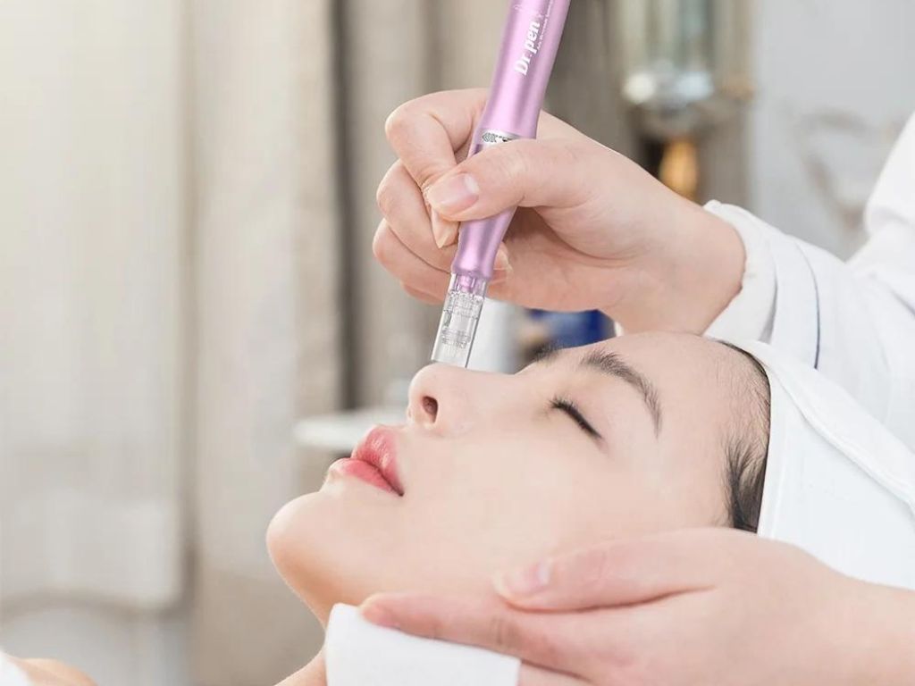 Microneedling