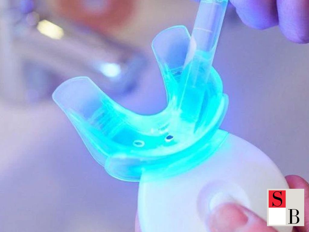 How to Use DIY Teeth Whitening Kits Effectively in Singapore