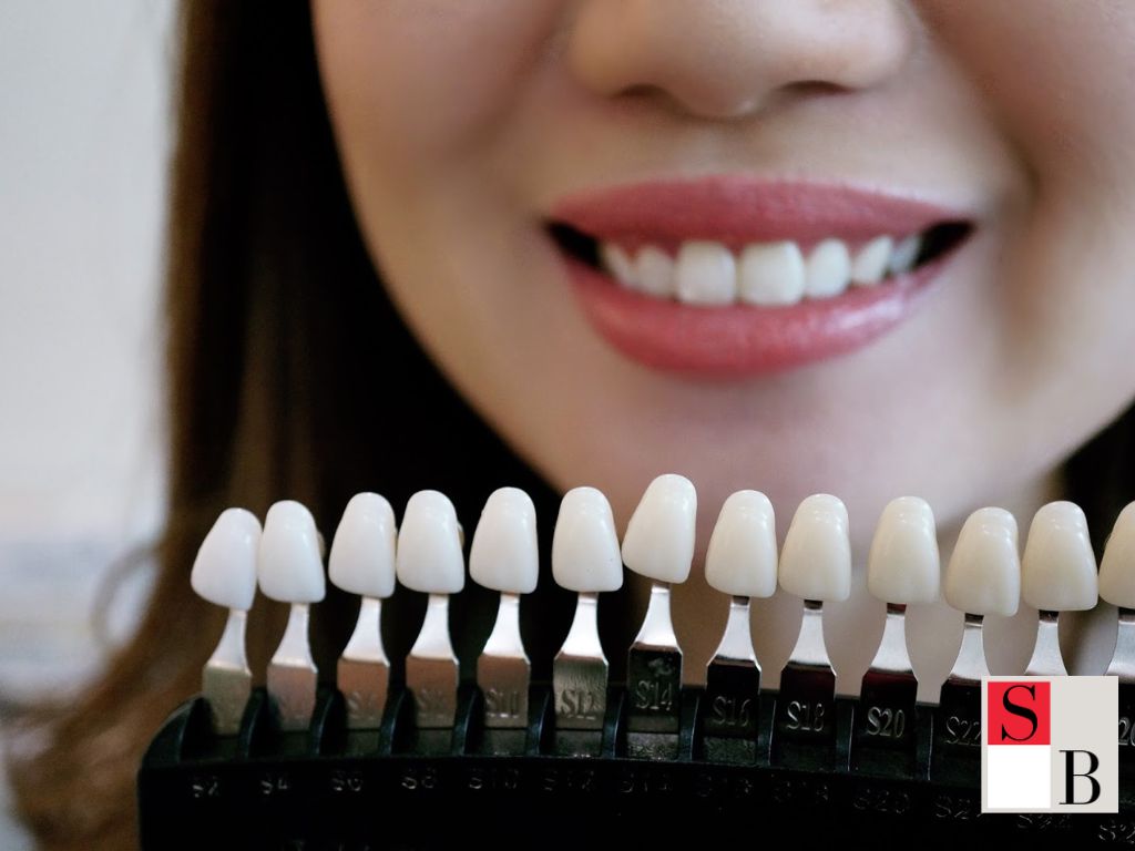 Benefits of LED Teeth Whitening