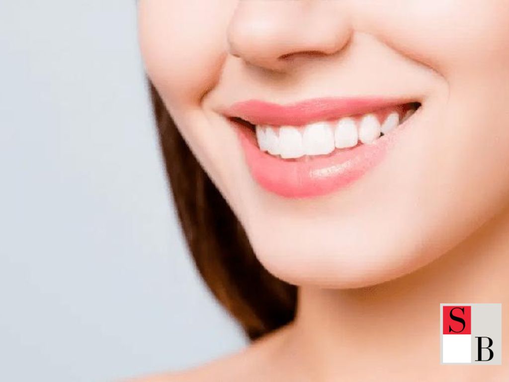 The Benefits of Teeth Whitening in Singapore