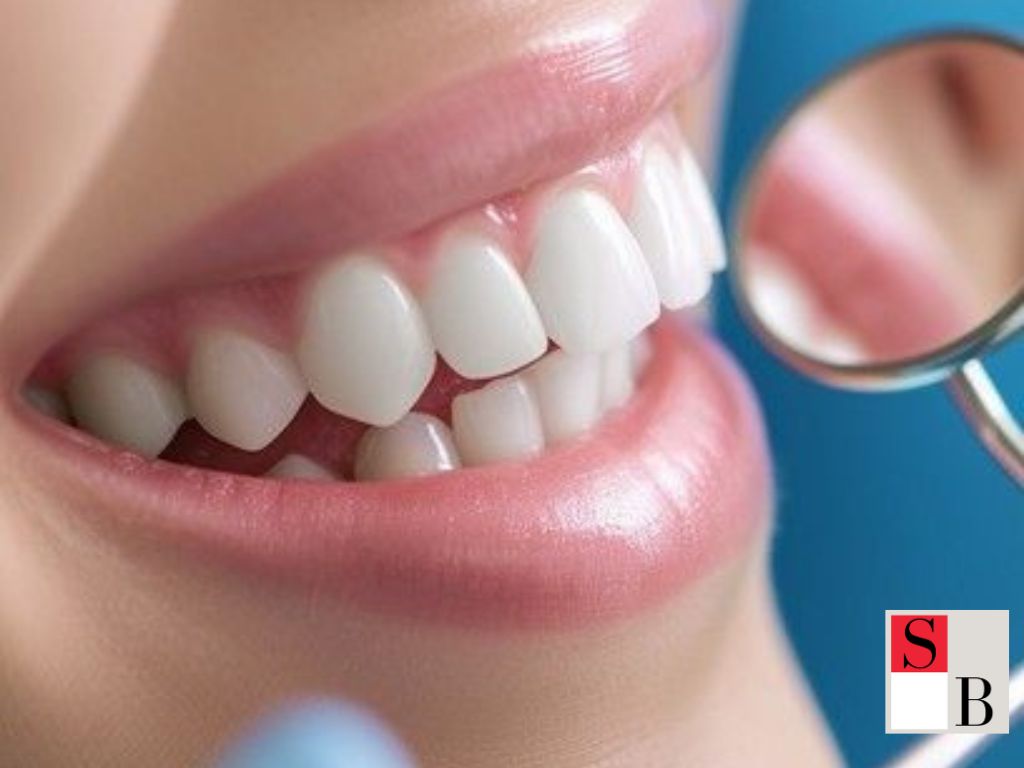 How to Whiten Your Teeth Effectively in Singapore