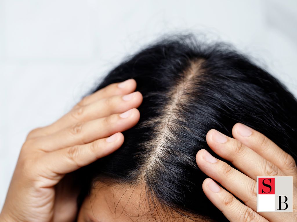 Practical Tips for Hair Regrowth in Singapore’s Tropical Climate