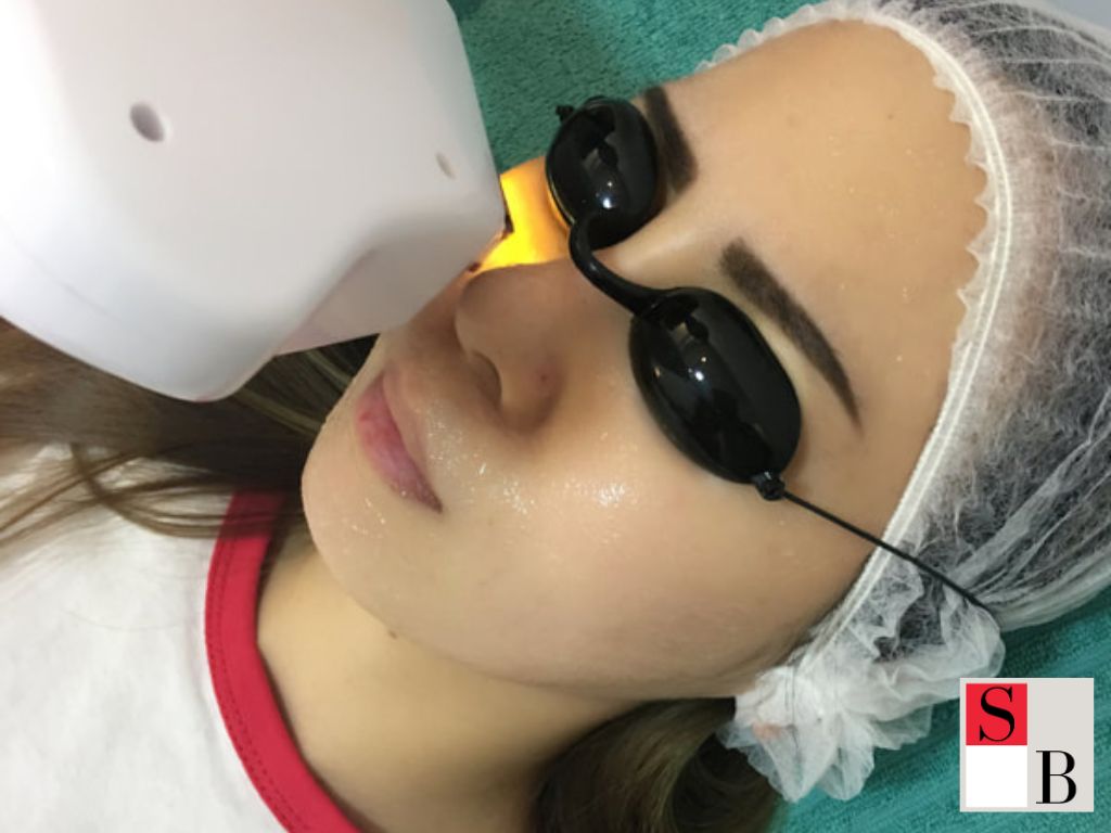 Professional RF Facial Solutions at Wellaholic