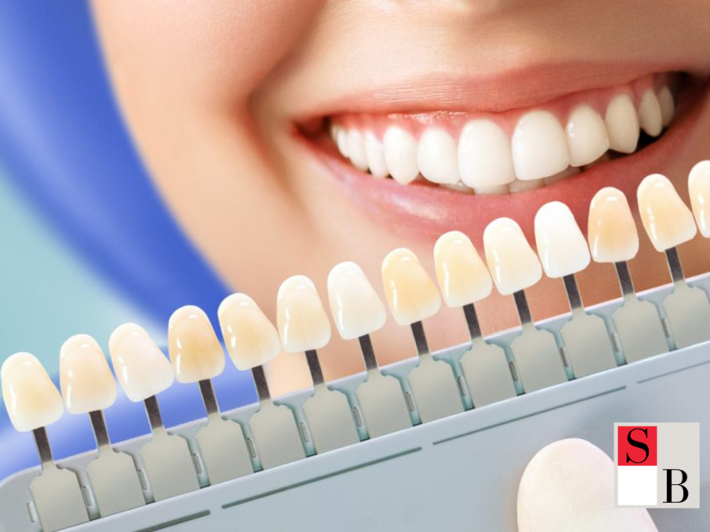 Implementing LED Teeth Whitening