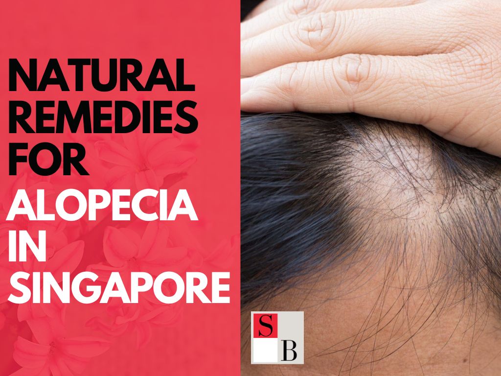 Natural Remedies for Alopecia in Singapore