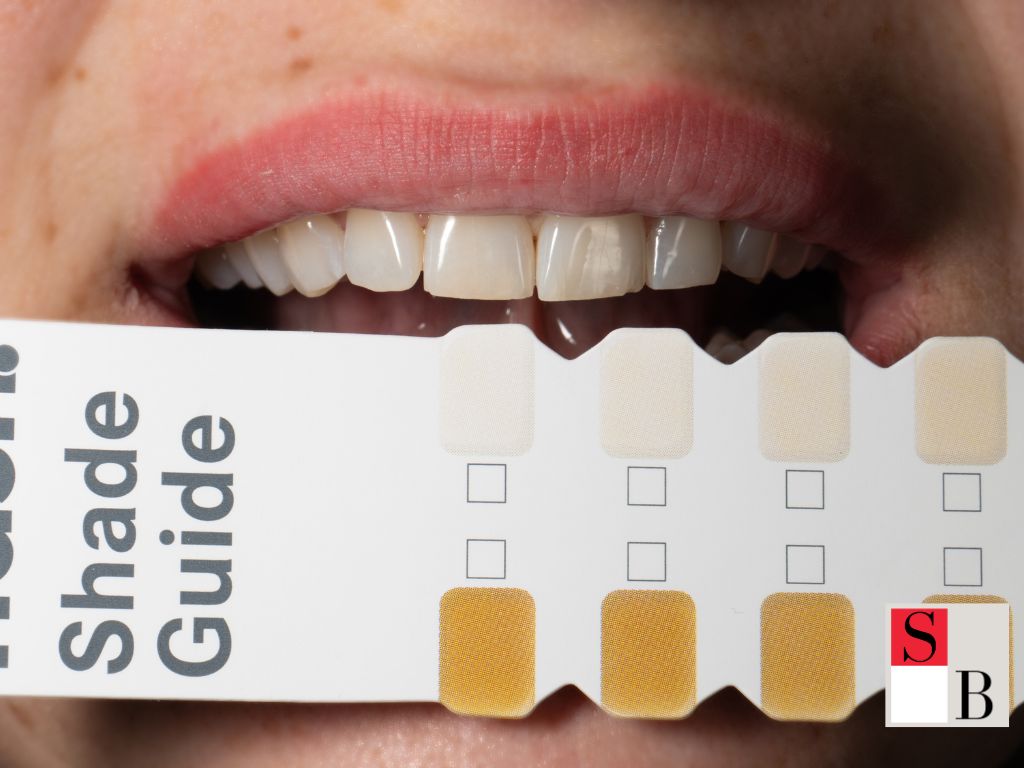 Benefits of LED Teeth Whitening for Singapore’s Busy Lifestyle