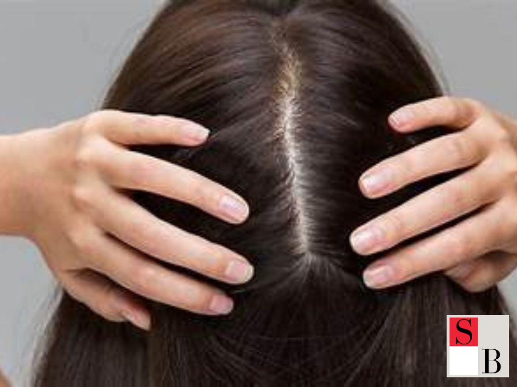 How to Incorporate Natural Alopecia Remedies in Singapore