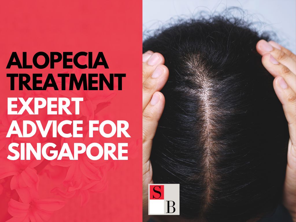 Alopecia Treatment: Expert Advice for Singapore