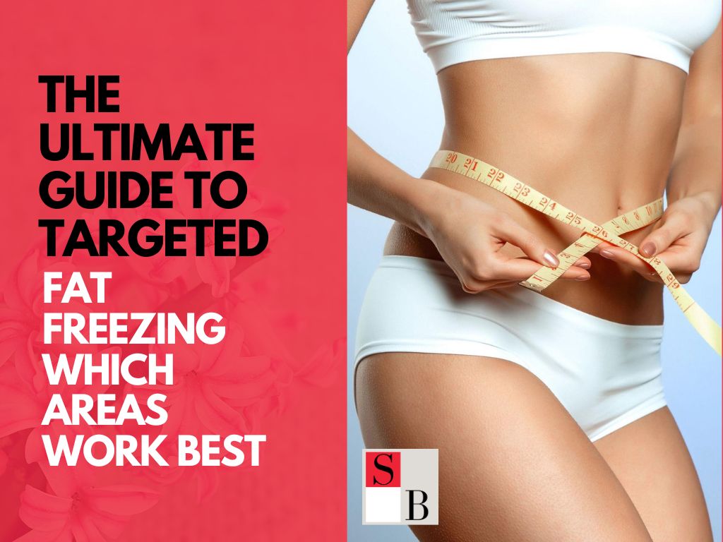 The Ultimate Guide to Targeted Fat Freezing: Which Areas Work Best?