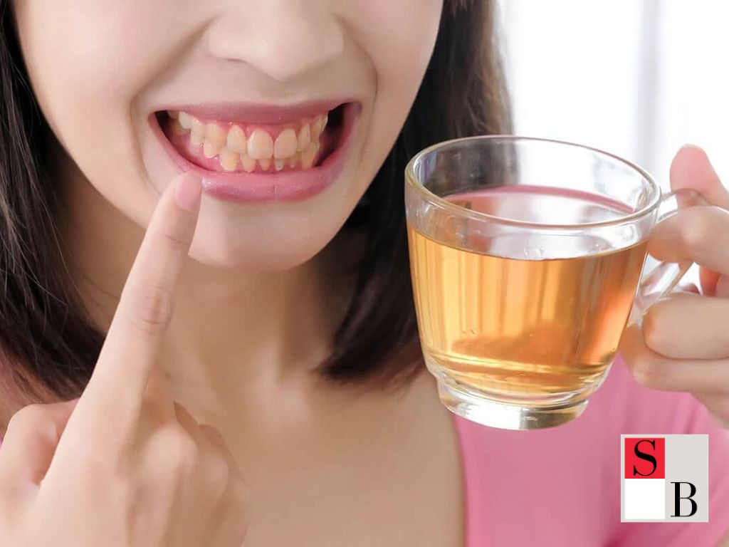 Why Do Singaporean Delights Stain Your Teeth?