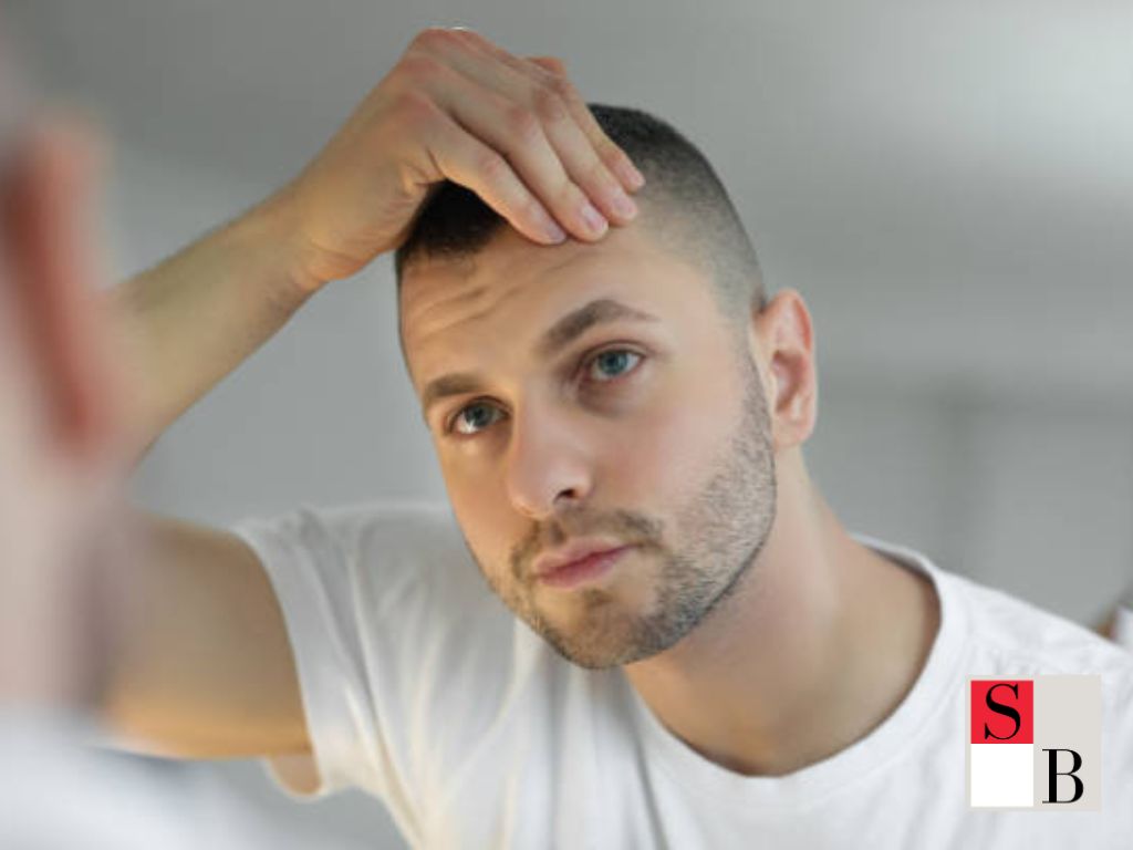 How Singaporean Women Can Support Hair Loss Treatment in Asian Men