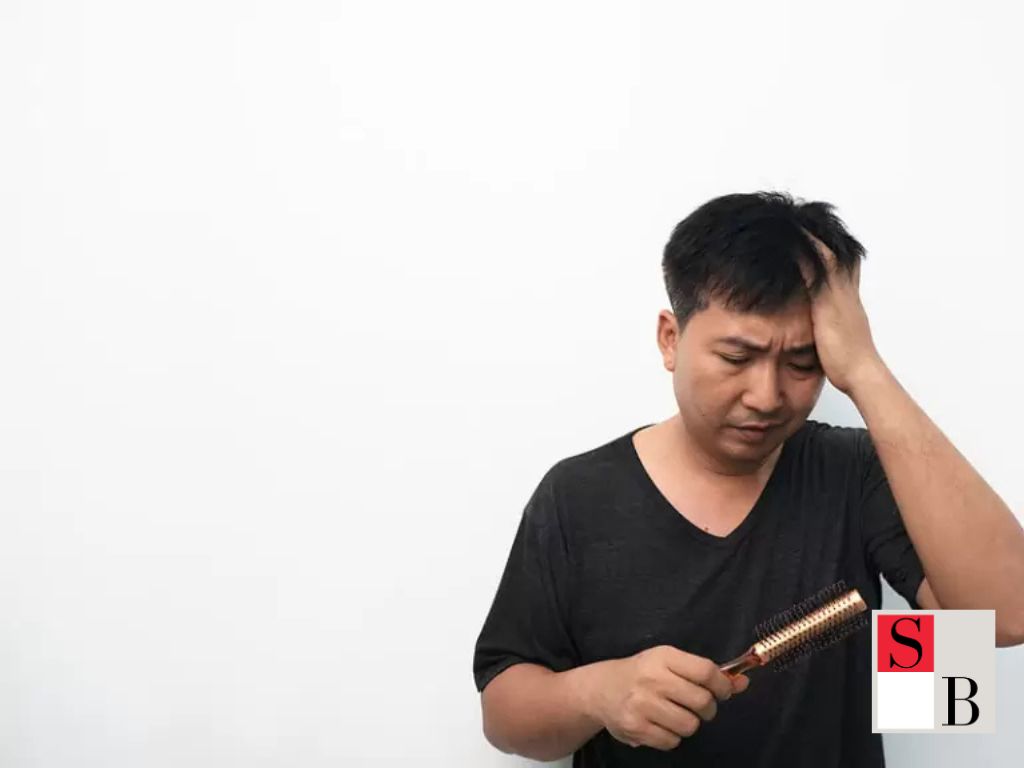 Understanding Hair Loss Patterns in Asian Men: What Singaporean Women Should Know