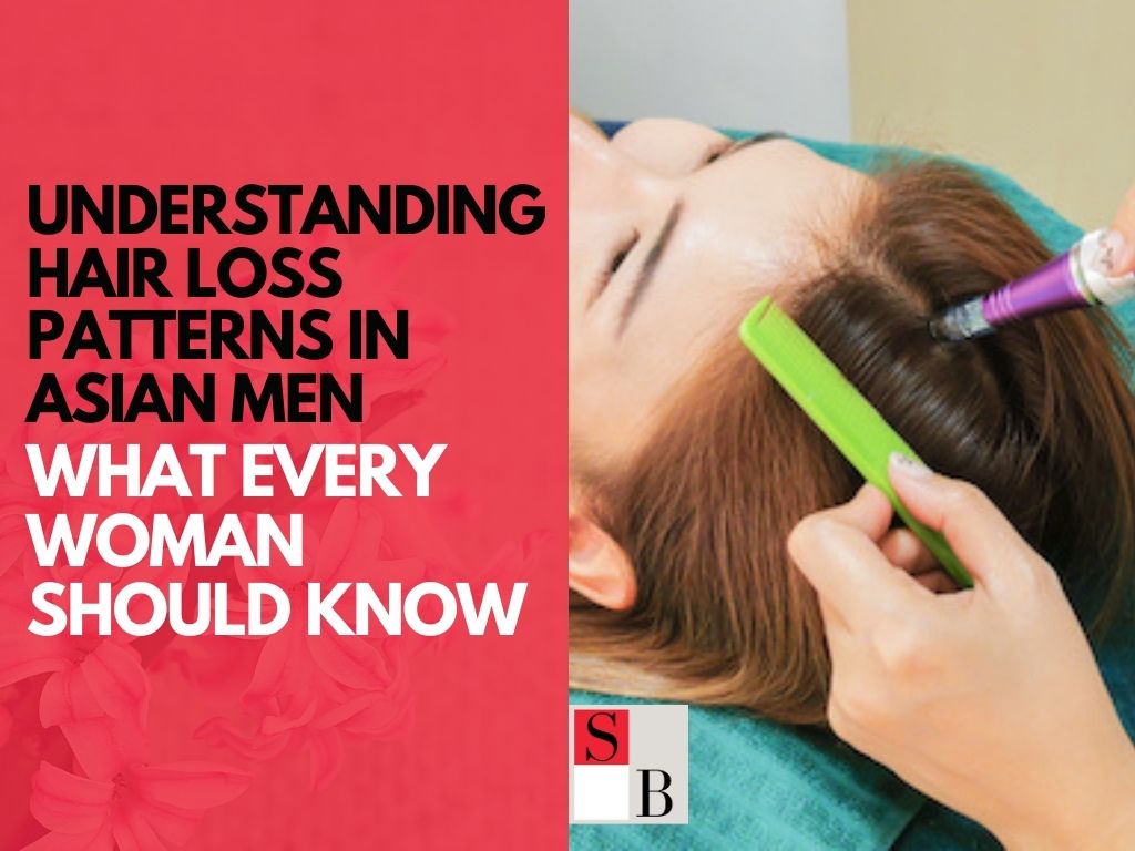 Understanding Hair Loss Patterns in Asian Men: What Every Woman Should Know