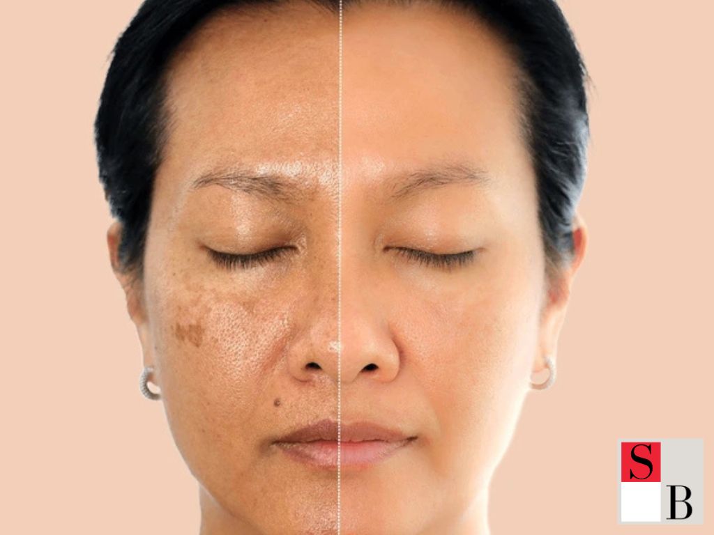 How to Build an Effective Facial Routine After 40 in Singapore