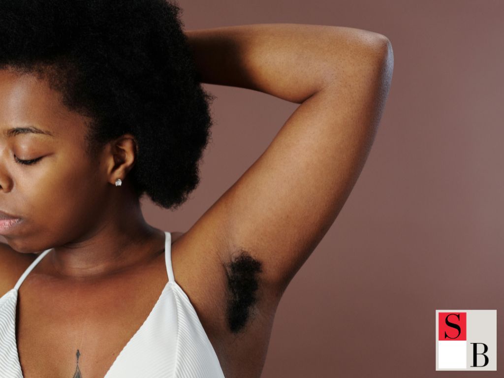 Hair Removal Trends in Singapore: What Every Style-Conscious Woman Should Know
