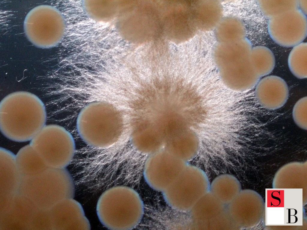 The Beauty Science Behind Fermented Foods