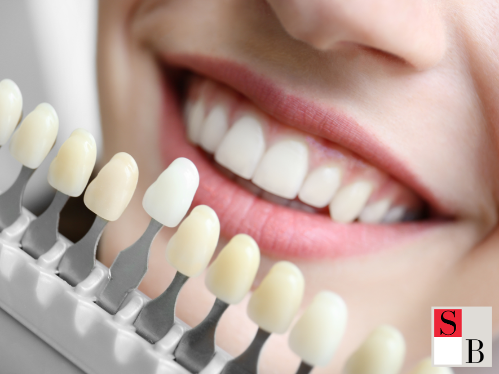 Achieve a Radiant Smile with Wellaholic’s Expert Teeth Whitening