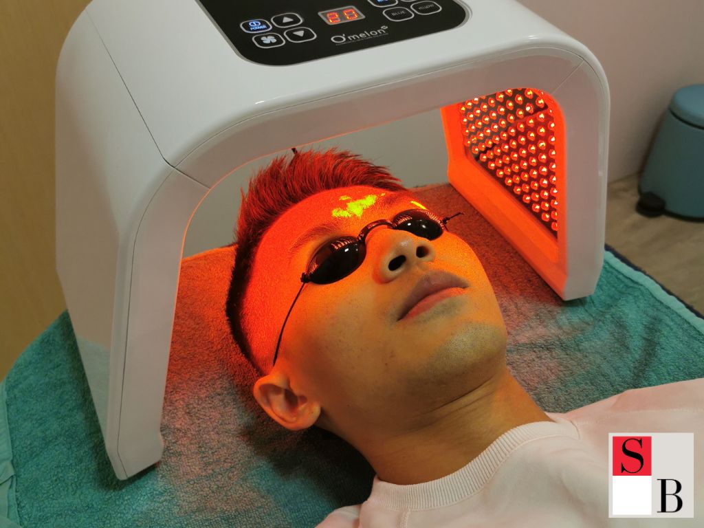 Professional Treatments for Long-Term Acne Control in Singapore