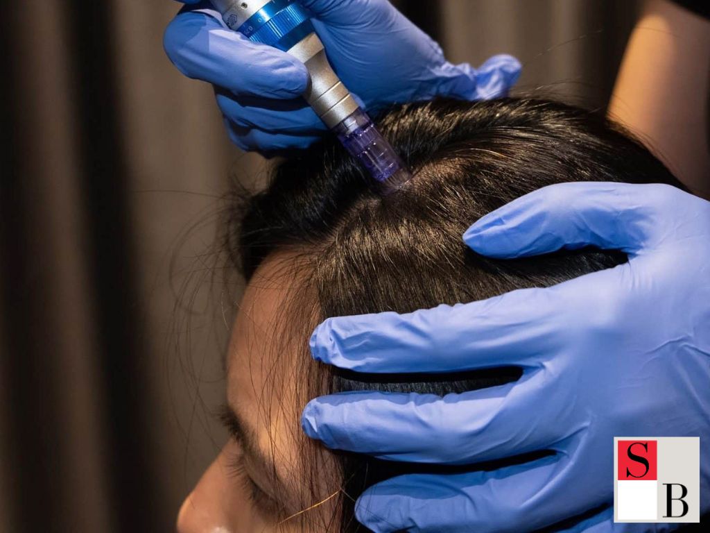 Professional Natural Hair Growth Treatments in Singapore with Wellaholic