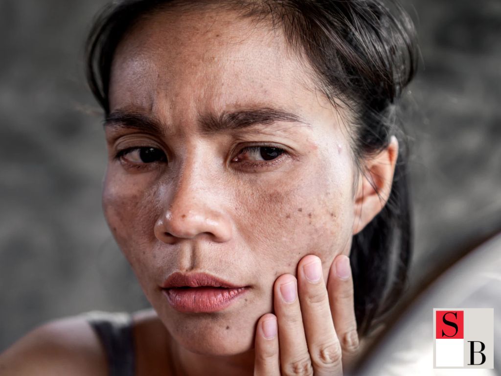 What Is Optimal Facial Spacing for Healthy Skin in Singapore?