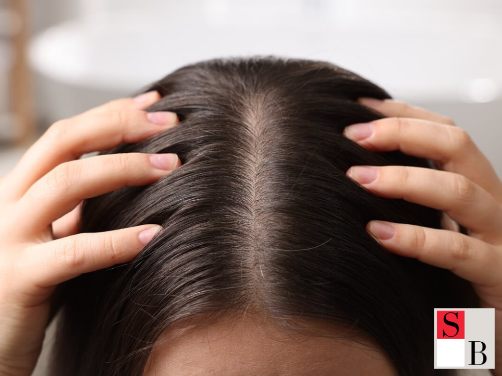 How Women Can Help Manage Male Hair Loss in Singapore