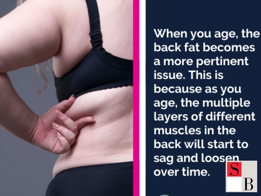 What Causes Bra Bulge and How Fat Freezing Targets Stubborn Areas