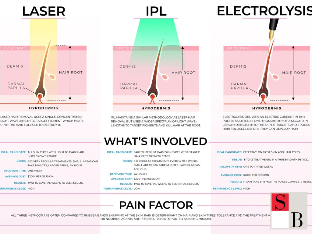 Why Professional Hair Removal is More Effective