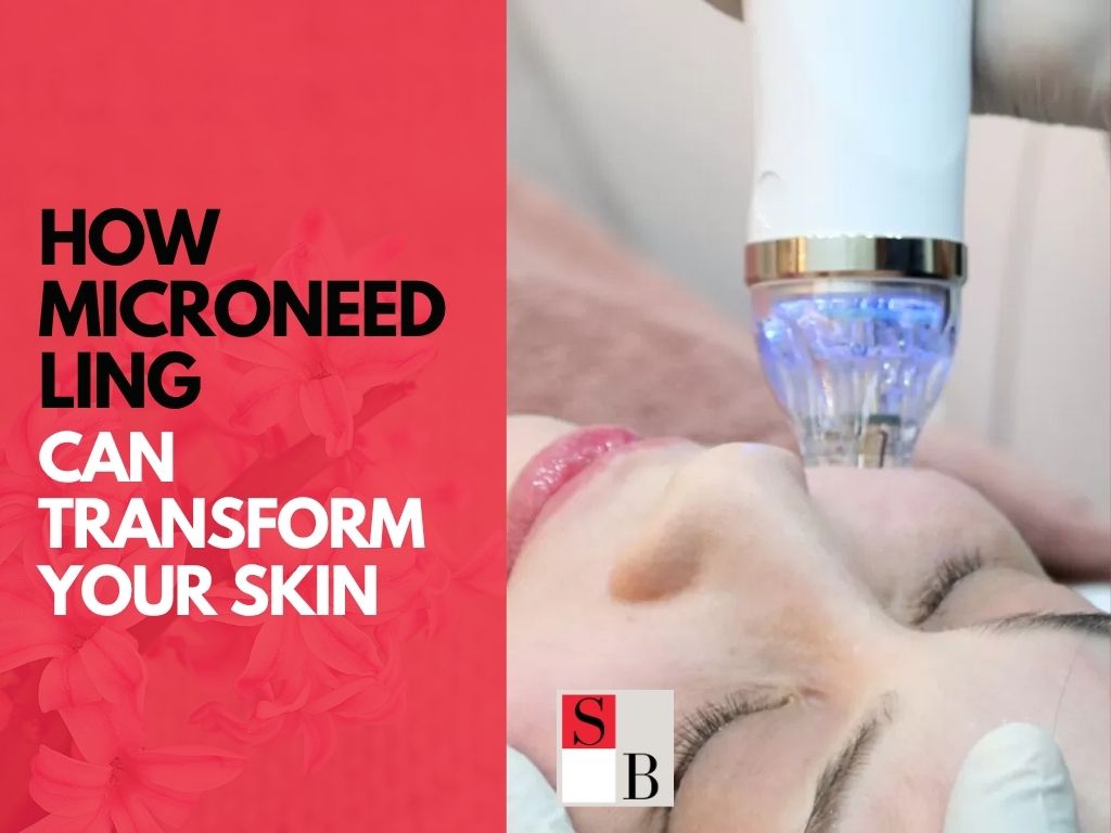 How Microneedling Can Transform Your Skin: A Singaporean’s Guide