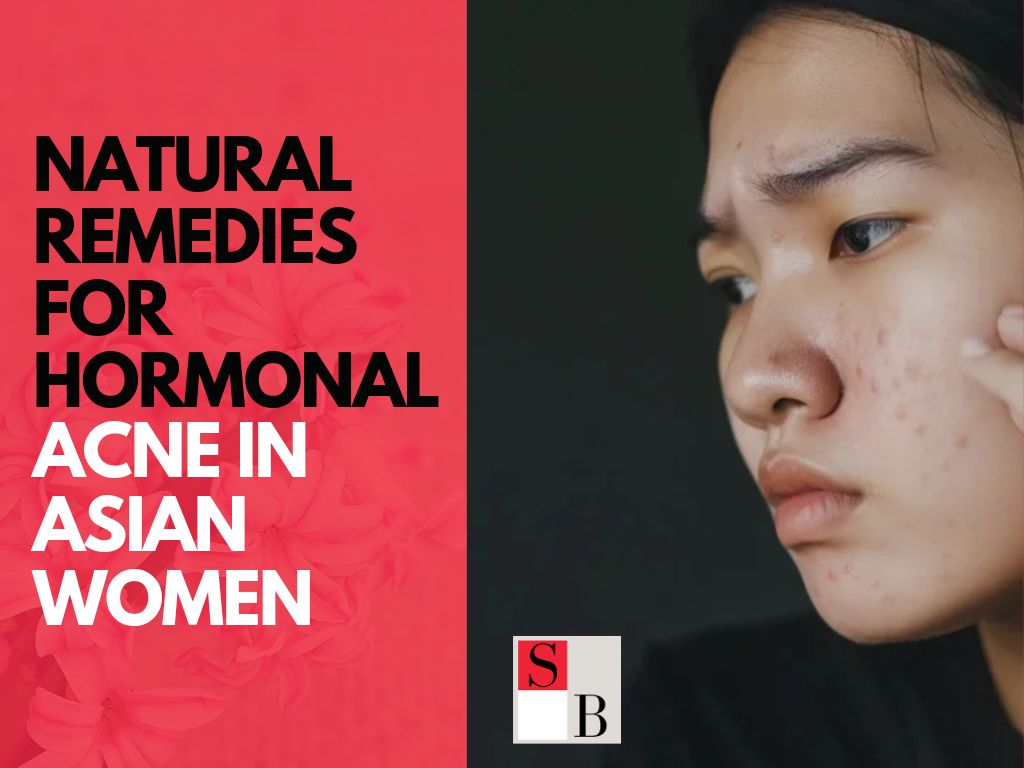 Natural Remedies for Hormonal Acne in Asian Women