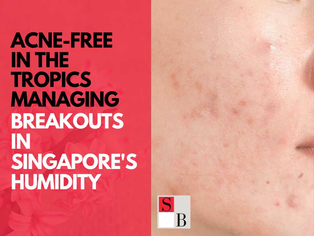Acne-Free in the Tropics Managing Breakouts in Singapore's Humidity