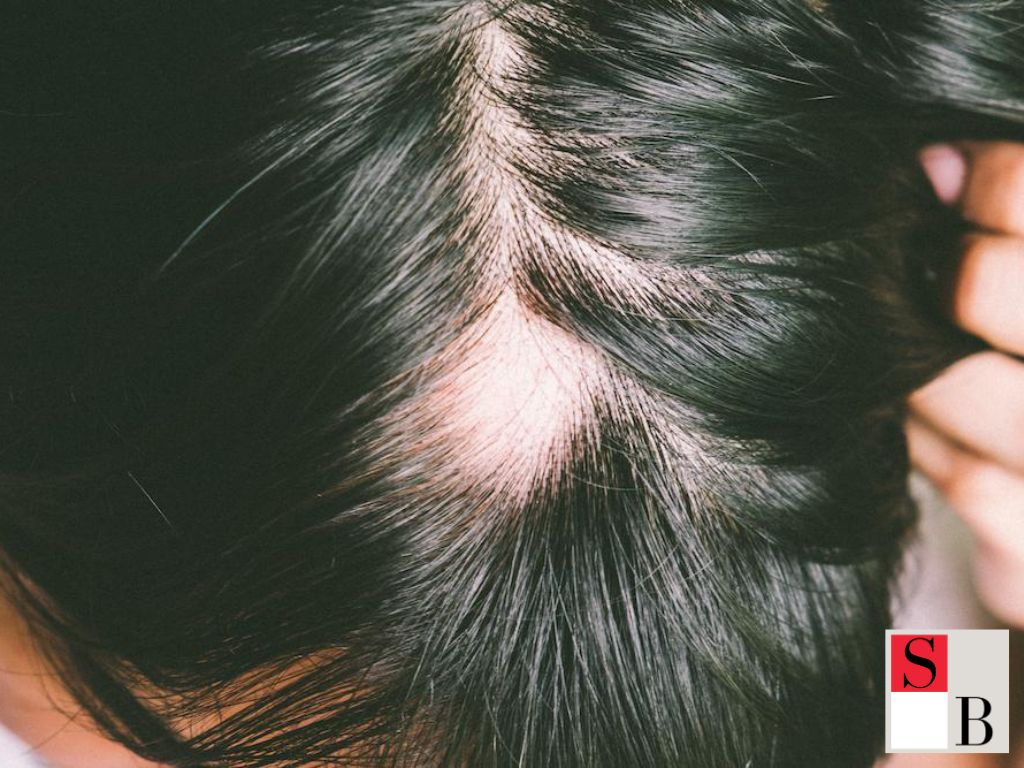 Why Early Detection of Hair Loss Matters