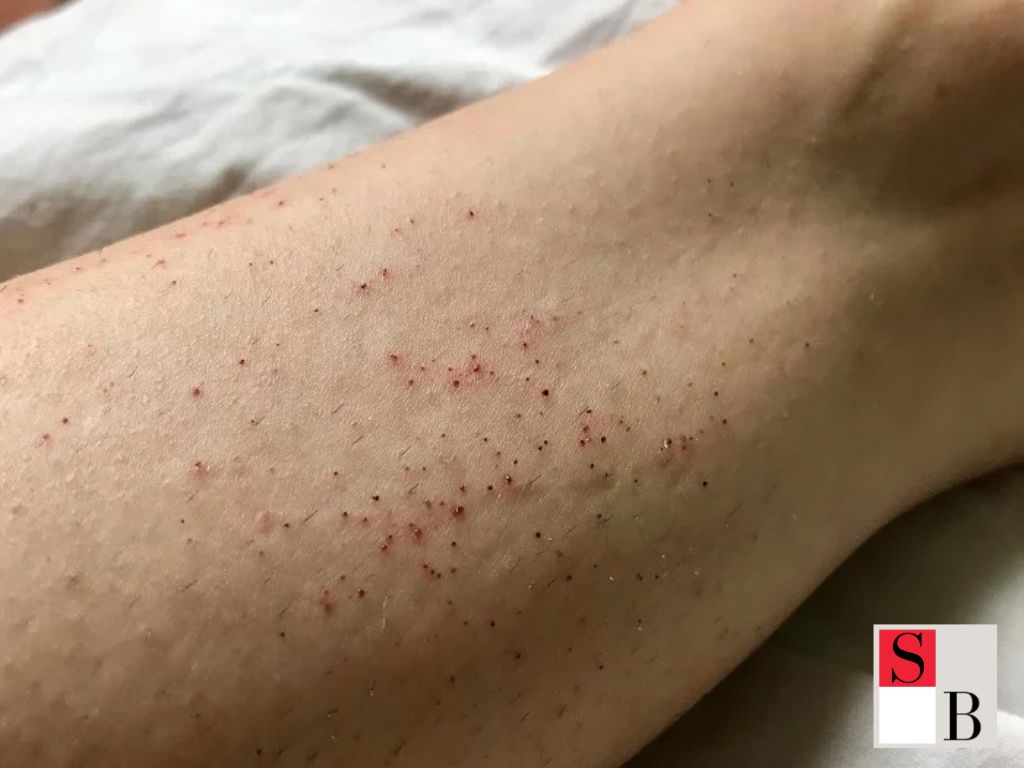 Benefits of Permanent Hair Removal for Singaporean Skin