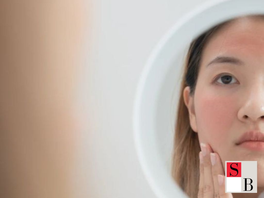 Understanding Sebum Control for Oily Skin in Singapore