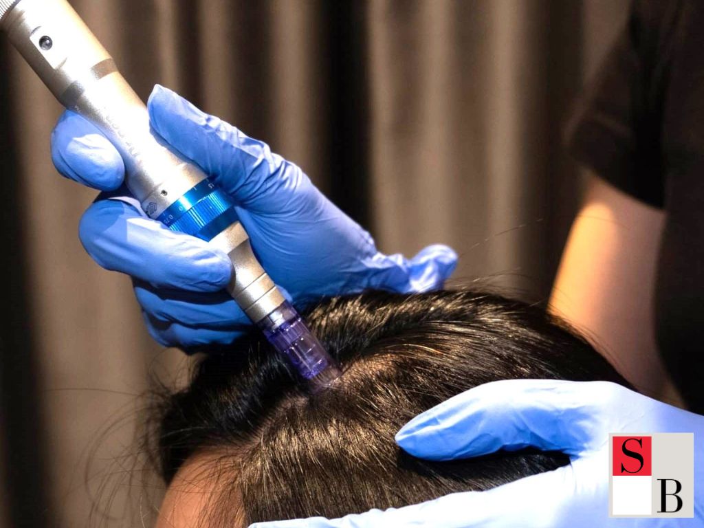 Professional Hair Growth Treatments in Singapore with Wellaholic