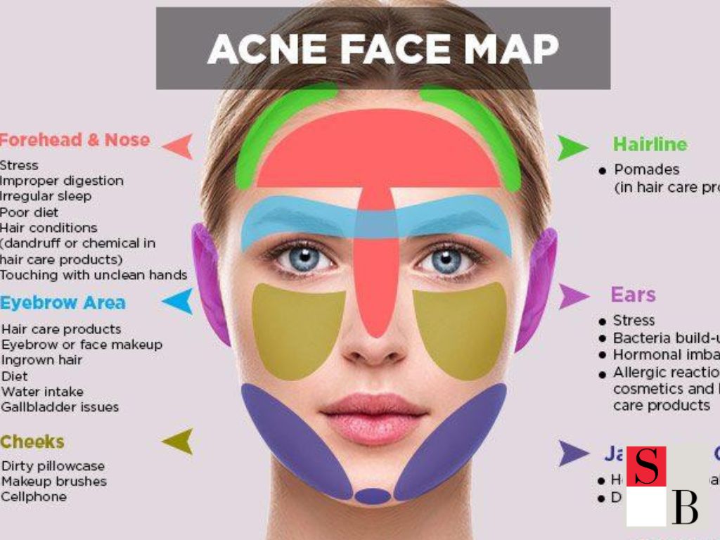 How to Break the Stress-Acne Cycle with Science-Backed Methods