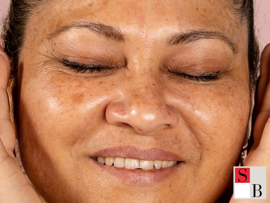 What Really Ages Your Skin in Singapore’s Climate