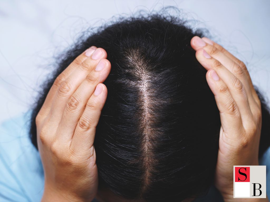 Understanding Hormonal Hair Loss in Asian Women