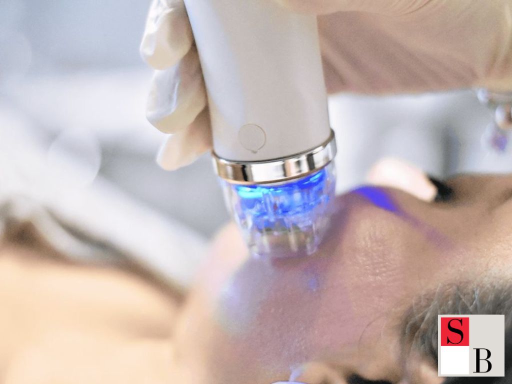 Proven RF Microneedling Solutions by Wellaholic in Singapore