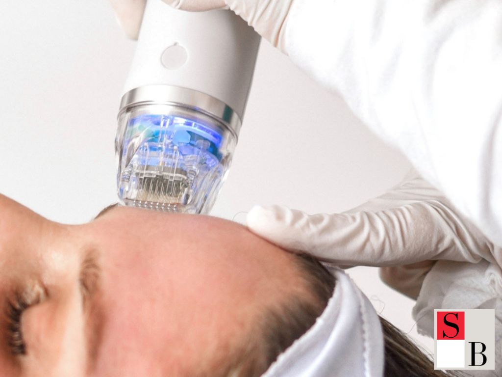 How to Start Microneedling Safely in Singapore