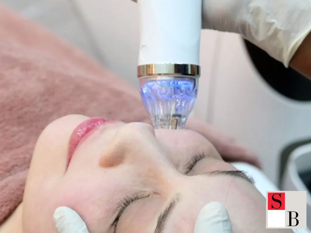 Gold RF Microneedling: Singapore’s Trusted Treatment by Wellaholic