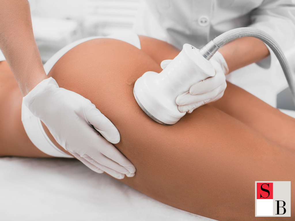 How to Apply Slimming Treatments in Real Life
