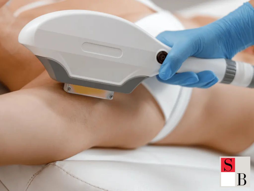 Why Permanent Hair Removal Is Gaining Popularity in Singapore