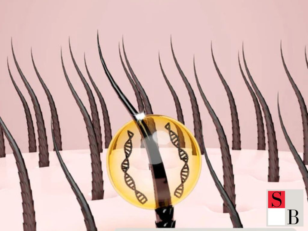 Everyday Hair Loss Remedies for SMU Students in Singapore