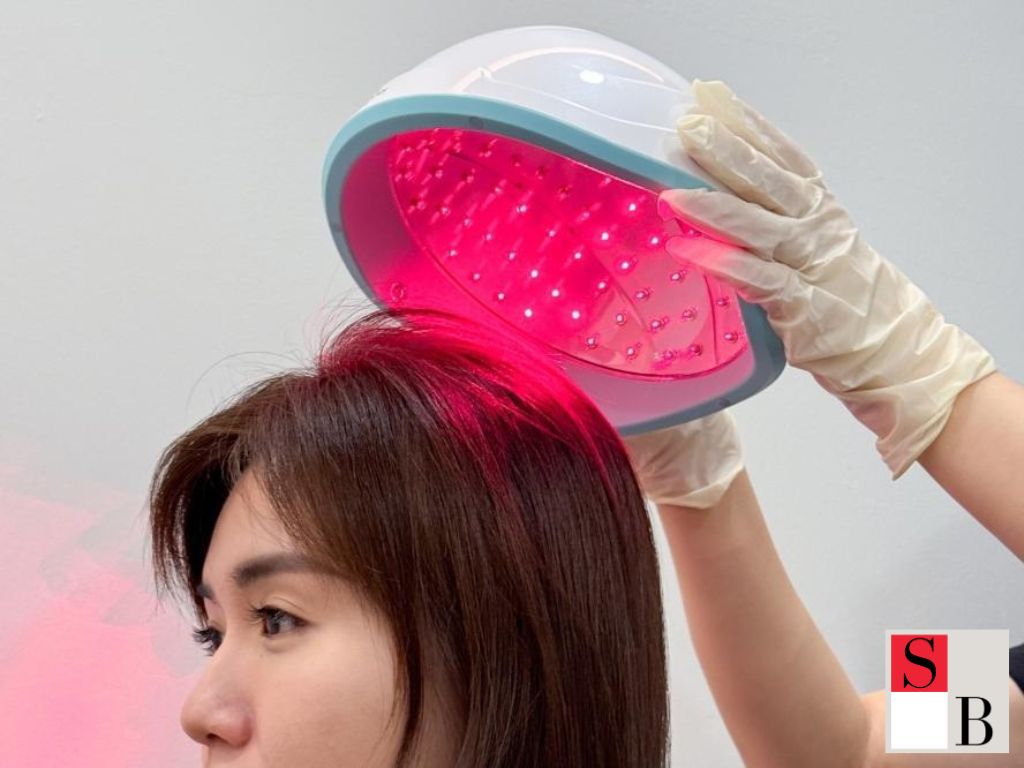 Practical Ways to Address Hormonal Hair Loss in Singapore